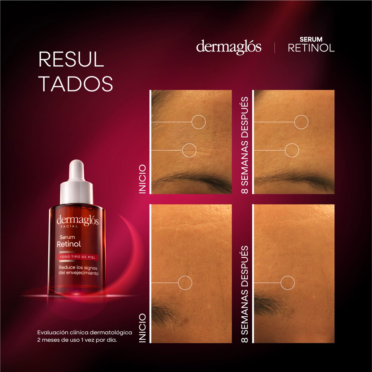 Serum Retinol Dermaglós Facial 25 ml - Imagen 11